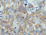 c-Cbl Antibody in Immunohistochemistry (Paraffin) (IHC (P))