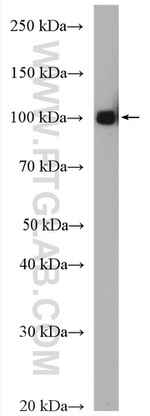 c-Cbl Antibody in Western Blot (WB)