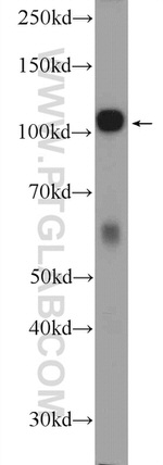 c-Cbl Antibody in Western Blot (WB)