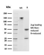 Kallikrein 5 (KLK5) Antibody in SDS-PAGE (SDS-PAGE)