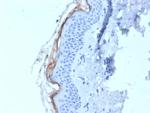 Kallikrein 5 (KLK5) Antibody in Immunohistochemistry (Paraffin) (IHC (P))