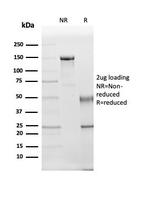 Kallikrein 5 (KLK5) Antibody in SDS-PAGE (SDS-PAGE)