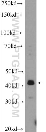 VSX2 Antibody in Western Blot (WB)