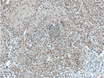 TFAP2E Antibody in Immunohistochemistry (Paraffin) (IHC (P))