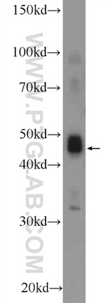 TFAP2E Antibody in Western Blot (WB)