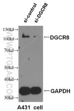 DGCR8 N-terminal Antibody in Western Blot (WB)