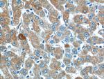 SMAD7 Antibody in Immunohistochemistry (Paraffin) (IHC (P))