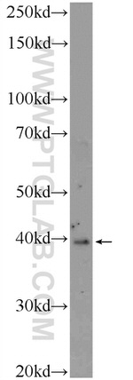 SMAD7 Antibody in Western Blot (WB)