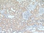 RAB11FIP3 Antibody in Immunohistochemistry (Paraffin) (IHC (P))