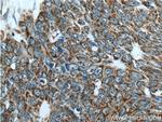 IDH3G Antibody in Immunohistochemistry (Paraffin) (IHC (P))