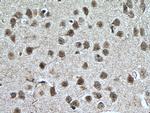 NR4A1 Antibody in Immunohistochemistry (Paraffin) (IHC (P))