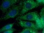 TH Antibody in Immunocytochemistry (ICC/IF)