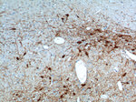 TH Antibody in Immunohistochemistry (Paraffin) (IHC (P))