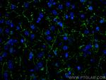 TH Antibody in Immunohistochemistry (PFA fixed) (IHC (PFA))