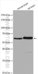 TH Antibody in Western Blot (WB)