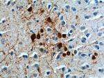 TH Antibody in Immunohistochemistry (Paraffin) (IHC (P))