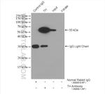 TH Antibody in Immunoprecipitation (IP)