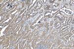 c-Met (Cytoplasmic) Antibody in Immunohistochemistry (Paraffin) (IHC (P))