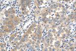 c-Met (Cytoplasmic) Antibody in Immunohistochemistry (Paraffin) (IHC (P))