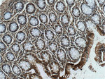 c-Met (Cytoplasmic) Antibody in Immunohistochemistry (Paraffin) (IHC (P))