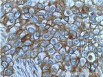 c-Met (Cytoplasmic) Antibody in Immunohistochemistry (Paraffin) (IHC (P))