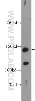 c-Met (Cytoplasmic) Antibody in Western Blot (WB)