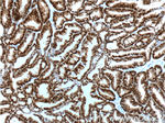 PR Antibody in Immunohistochemistry (Paraffin) (IHC (P))