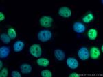 PR Antibody in Immunocytochemistry (ICC/IF)