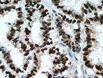 PR Antibody in Immunohistochemistry (Paraffin) (IHC (P))