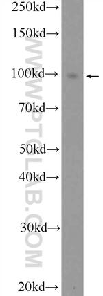 PR Antibody in Western Blot (WB)