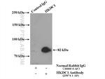 HKDC1 Antibody in Immunoprecipitation (IP)
