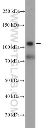 HKDC1 Antibody in Western Blot (WB)