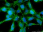 Chk1 Antibody in Immunocytochemistry (ICC/IF)