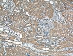 Chk1 Antibody in Immunohistochemistry (Paraffin) (IHC (P))