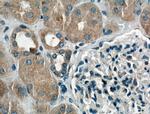 Chk1 Antibody in Immunohistochemistry (Paraffin) (IHC (P))