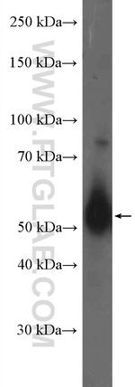 Chk1 Antibody in Western Blot (WB)