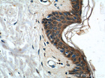 EDA Antibody in Immunohistochemistry (Paraffin) (IHC (P))