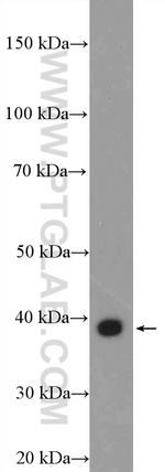 EDA Antibody in Western Blot (WB)