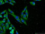 MTR Antibody in Immunocytochemistry (ICC/IF)