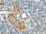 MTR Antibody in Immunohistochemistry (Paraffin) (IHC (P))