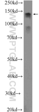 MTR Antibody in Western Blot (WB)