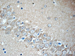 KIF5C Antibody in Immunohistochemistry (Paraffin) (IHC (P))