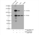 KIF5C Antibody in Immunoprecipitation (IP)