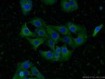 KIF5C Antibody in Immunocytochemistry (ICC/IF)