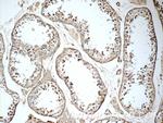 KIF5C Antibody in Immunohistochemistry (Paraffin) (IHC (P))