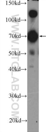 KIF5C Antibody in Western Blot (WB)