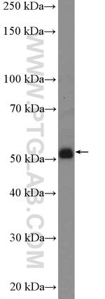 GABRR1 Antibody in Western Blot (WB)