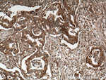 ADAM10 Antibody in Immunohistochemistry (Paraffin) (IHC (P))