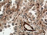 ADAM10 Antibody in Immunohistochemistry (Paraffin) (IHC (P))