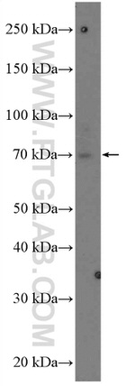 ADAM10 Antibody in Western Blot (WB)